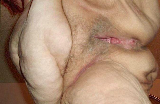 Old Wrinkled Pussy